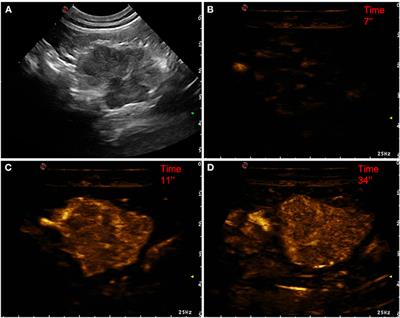 Contrast-enhanced ultrasound features of focal pancreatic lesions in cats